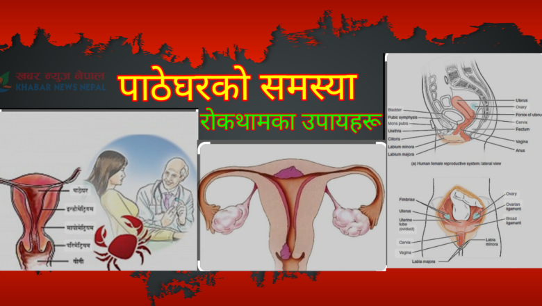 पाठेघर (गर्भाशय) को समस्याकारण र राेकथामकाे उपाय